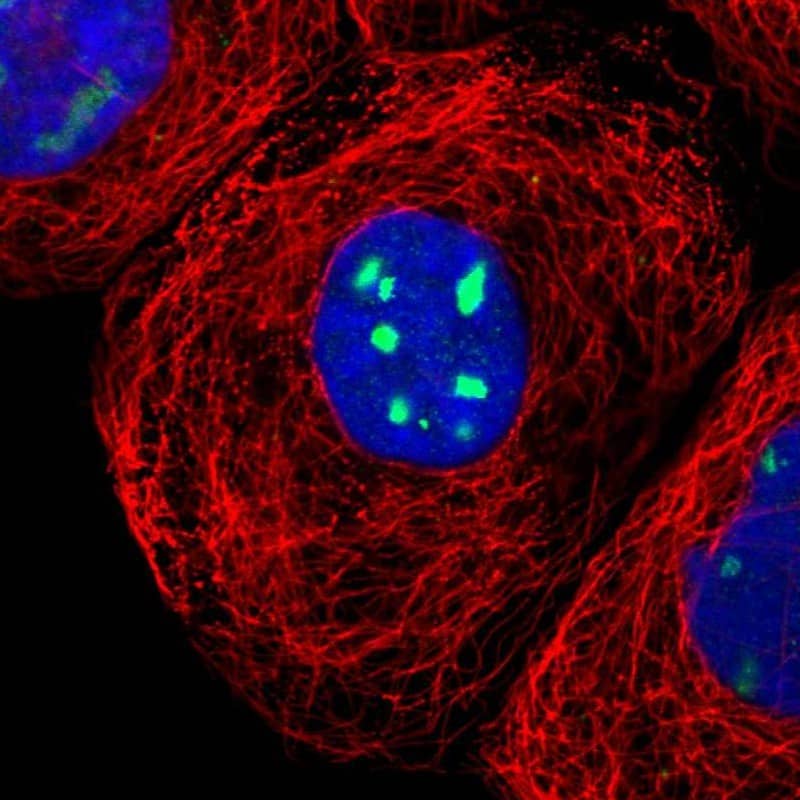 RRP1 Antibody - BSA Free Immunocytochemistry/ Immunofluorescence: RRP1 Antibody [NBP1-85338]