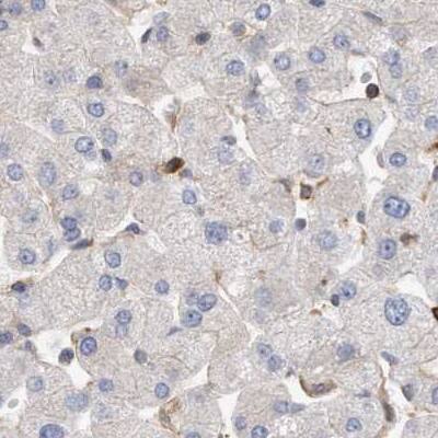 NSP 5 alpha 3 alpha Antibody - BSA Free Immunohistochemistry-Paraffin: NSP 5 alpha 3 alpha Antibody [NBP1-85352]