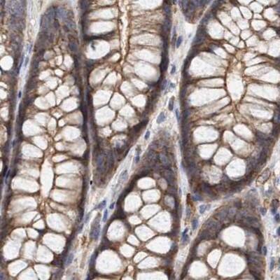 NSP 5 alpha 3 alpha Antibody - BSA Free Immunohistochemistry-Paraffin: NSP 5 alpha 3 alpha Antibody [NBP1-85352]