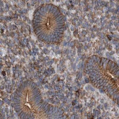 NSP 5 alpha 3 alpha Antibody - BSA Free Immunohistochemistry-Paraffin: NSP 5 alpha 3 alpha Antibody [NBP1-85352]