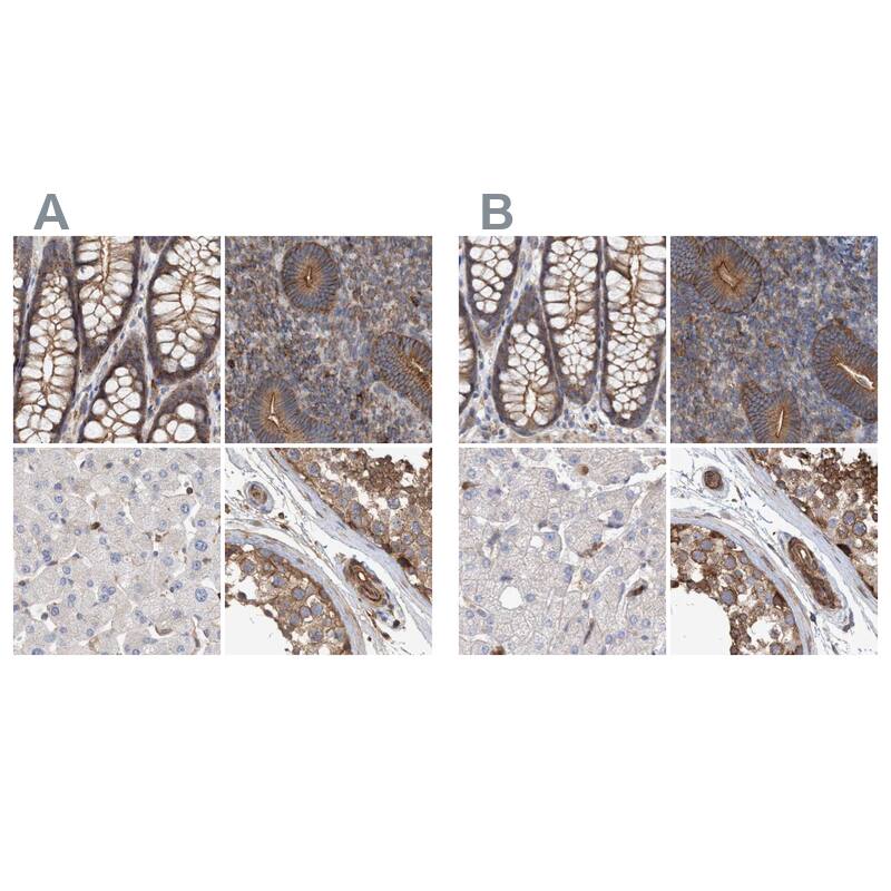 NSP 5 alpha 3 alpha Antibody - BSA Free Immunohistochemistry-Paraffin: NSP 5 alpha 3 alpha Antibody [NBP1-85352]
