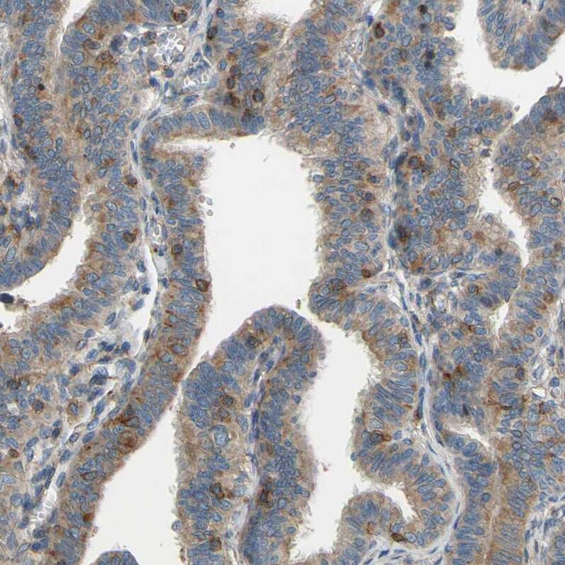 POR/Cytochrome P450 Reductase Antibody - BSA Free Immunohistochemistry-Paraffin: POR/Cytochrome P450 Reductase Antibody [NBP1-85357]