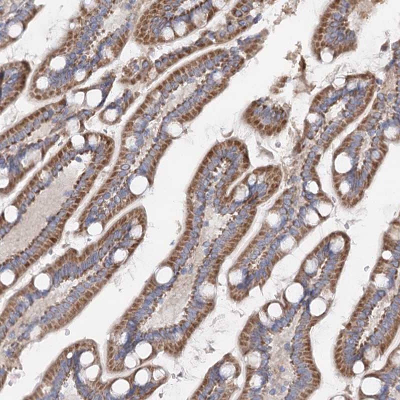 TMEM187 Antibody - BSA Free Immunohistochemistry-Paraffin: TMEM187 Antibody [NBP1-85373]