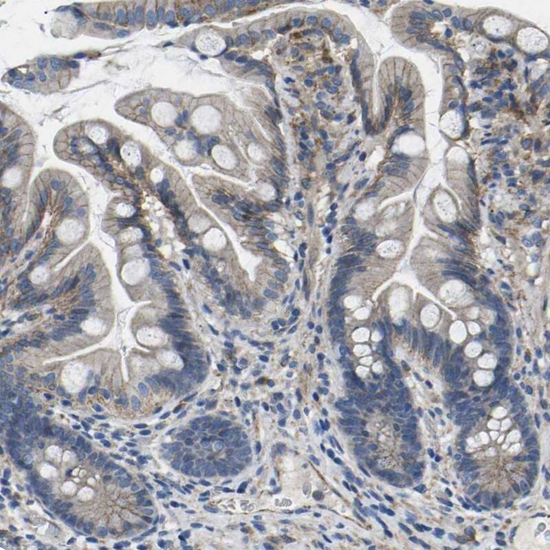 p120-catenin Antibody - BSA Free Immunohistochemistry-Paraffin: p120-catenin Antibody [NBP1-85383]