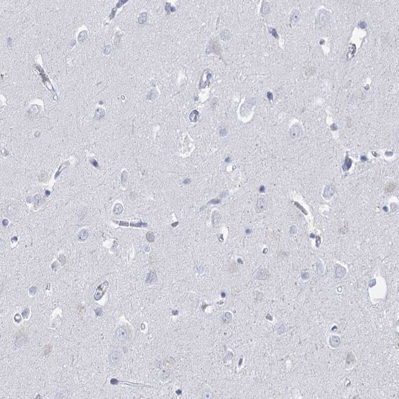 HORMAD1 Antibody - BSA Free Immunohistochemistry-Paraffin: HORMAD1 Antibody [NBP1-85401]