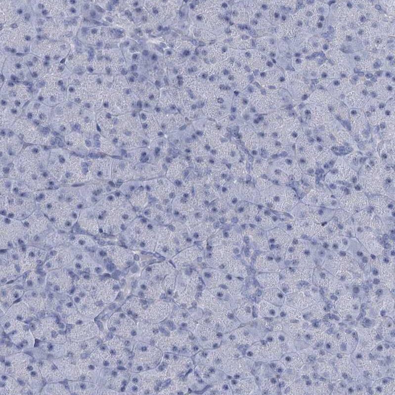 HORMAD1 Antibody - BSA Free Immunohistochemistry-Paraffin: HORMAD1 Antibody [NBP1-85401]