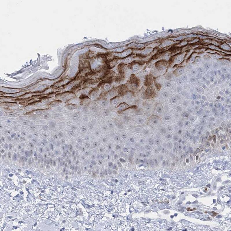 HORMAD1 Antibody - BSA Free Immunohistochemistry-Paraffin: HORMAD1 Antibody [NBP1-85401]