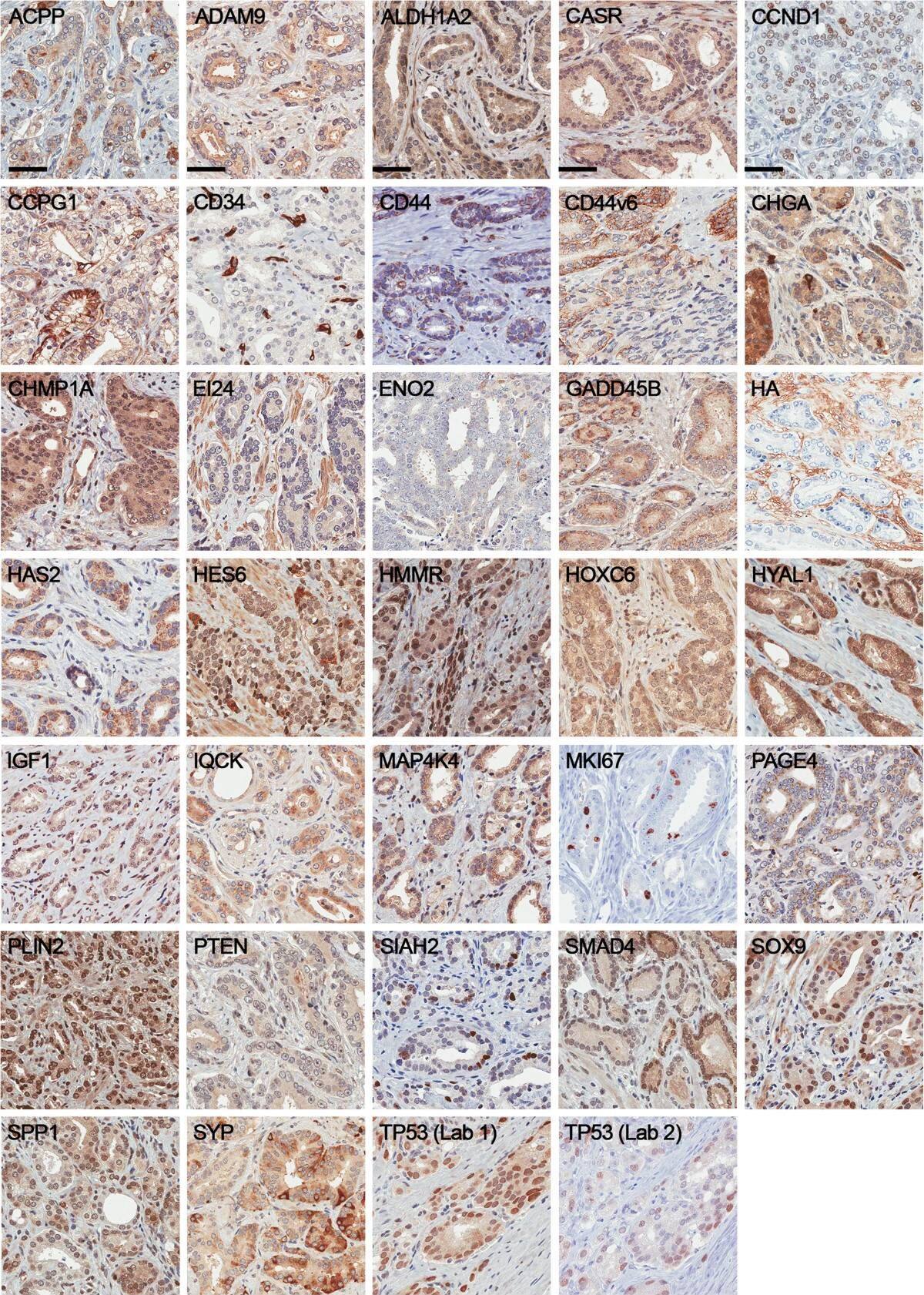 PAGE4 Antibody