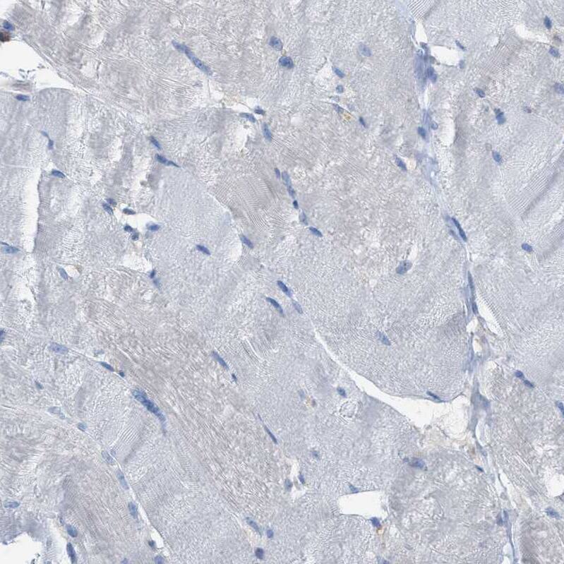 Cystatin B/Stefin B Antibody - BSA Free Immunohistochemistry-Paraffin: Cystatin B/Stefin B Antibody [NBP1-85430]