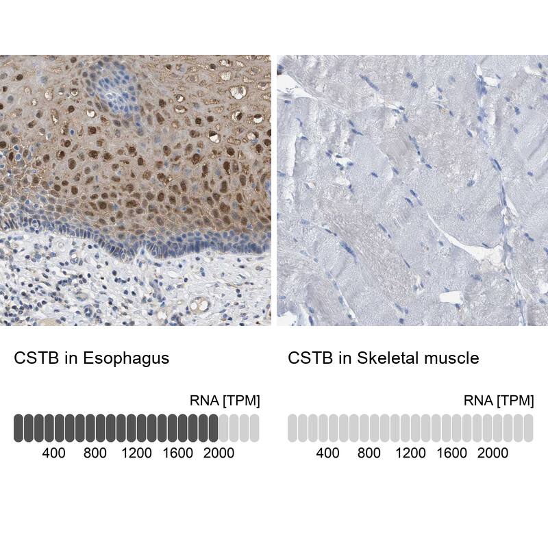 Cystatin B/Stefin B Antibody - BSA Free Immunohistochemistry-Paraffin: Cystatin B/Stefin B Antibody [NBP1-85430]