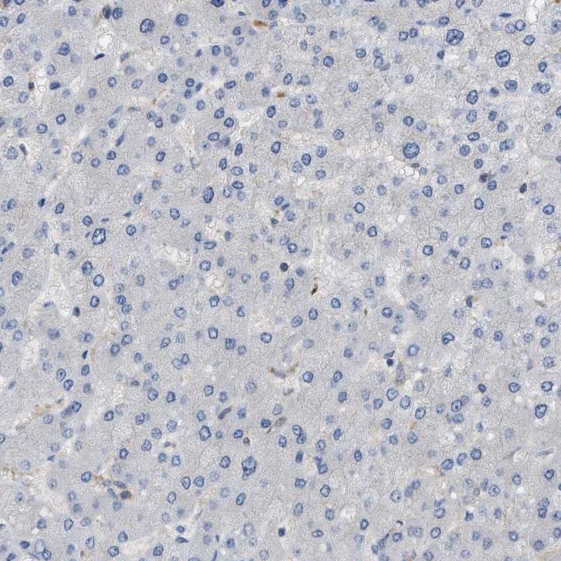 Cystatin B/Stefin B Antibody - BSA Free Immunohistochemistry-Paraffin: Cystatin B/Stefin B Antibody [NBP1-85430]