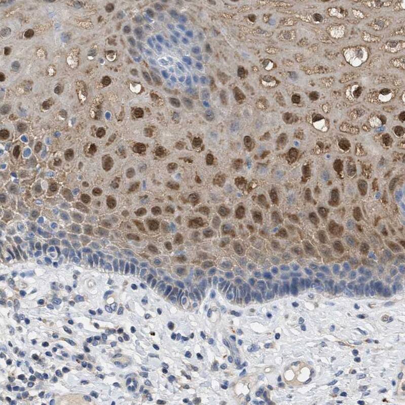Cystatin B/Stefin B Antibody - BSA Free Immunohistochemistry-Paraffin: Cystatin B/Stefin B Antibody [NBP1-85430]