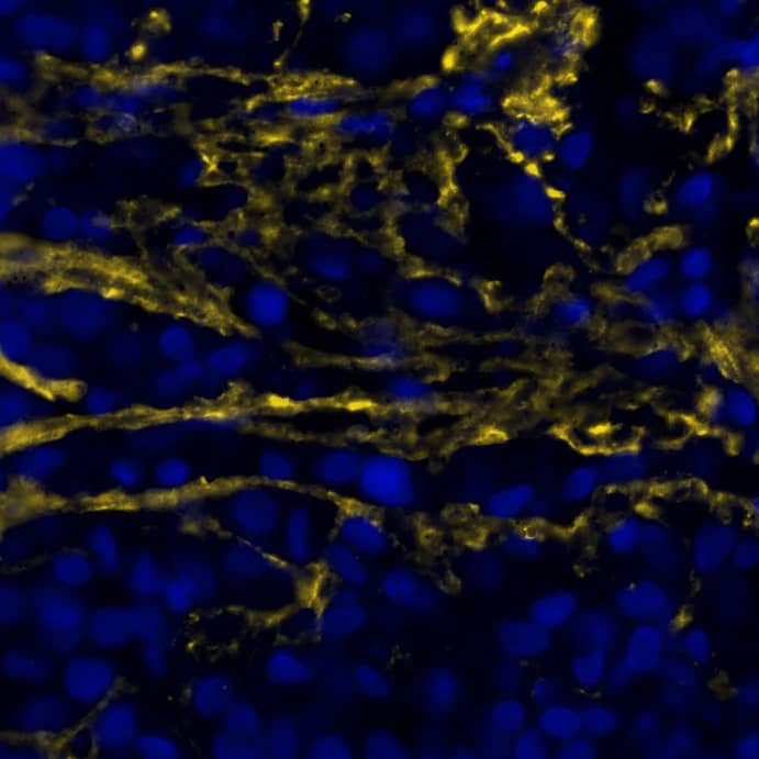Versican Antibody - BSA Free
