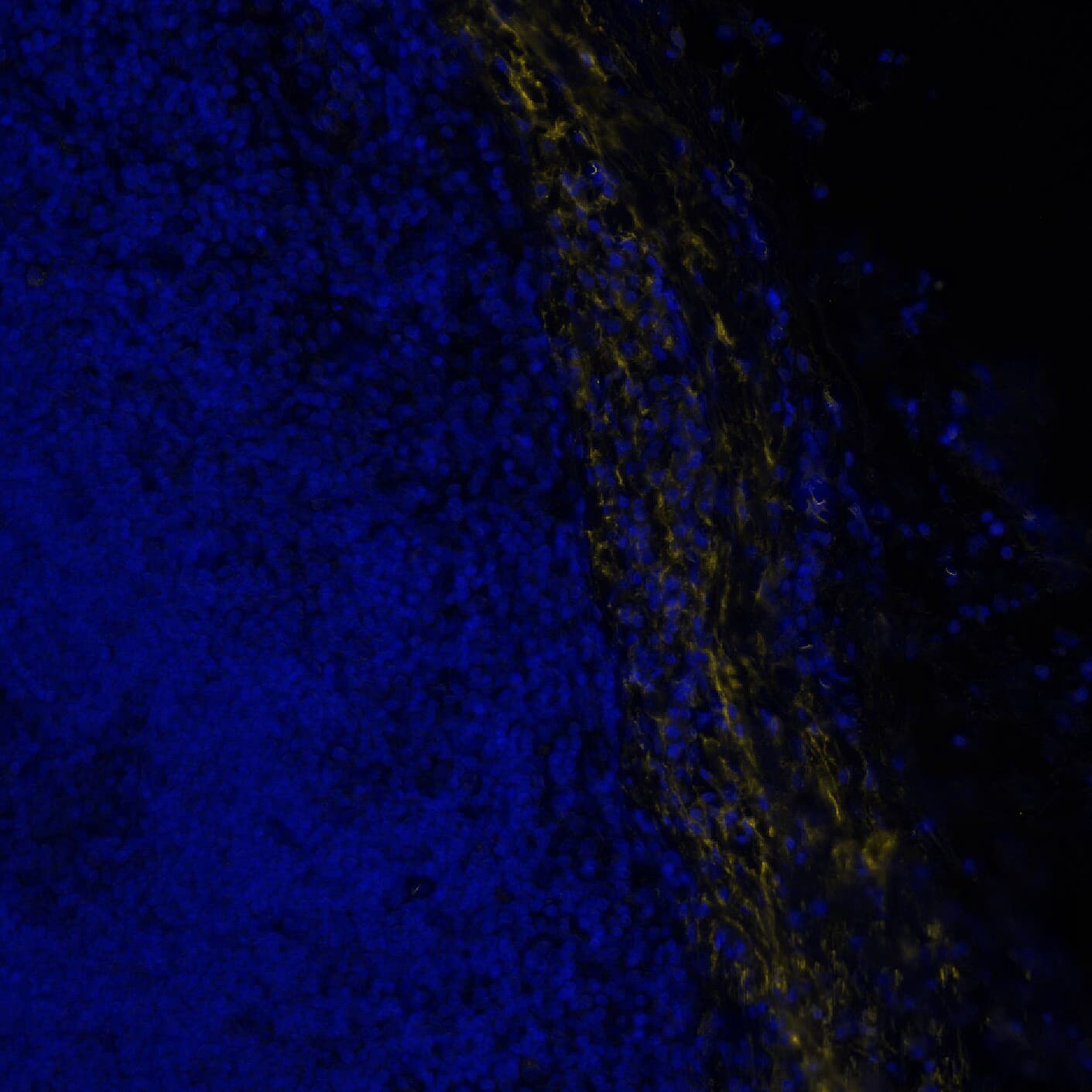 Versican Antibody - BSA Free