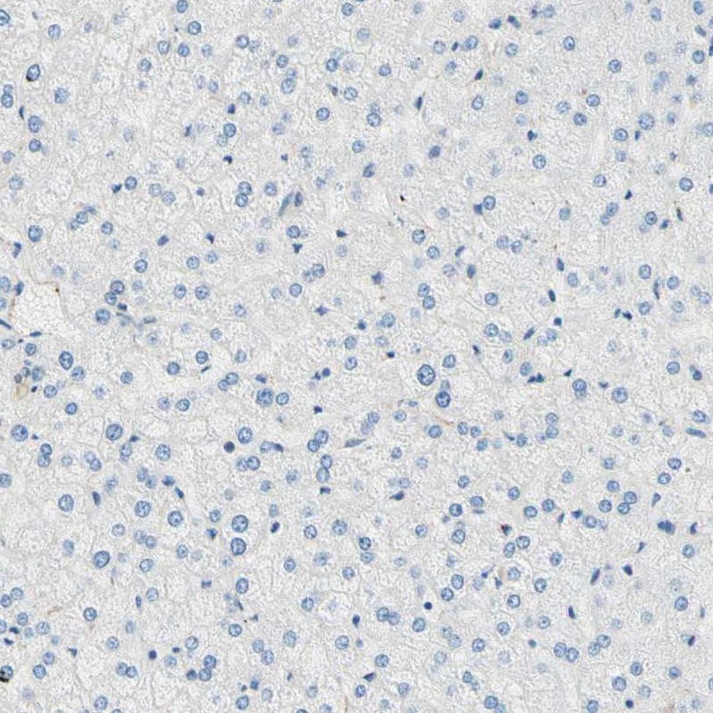 CRMP4 Antibody - BSA Free Immunohistochemistry-Paraffin: CRMP4 Antibody [NBP1-85447]