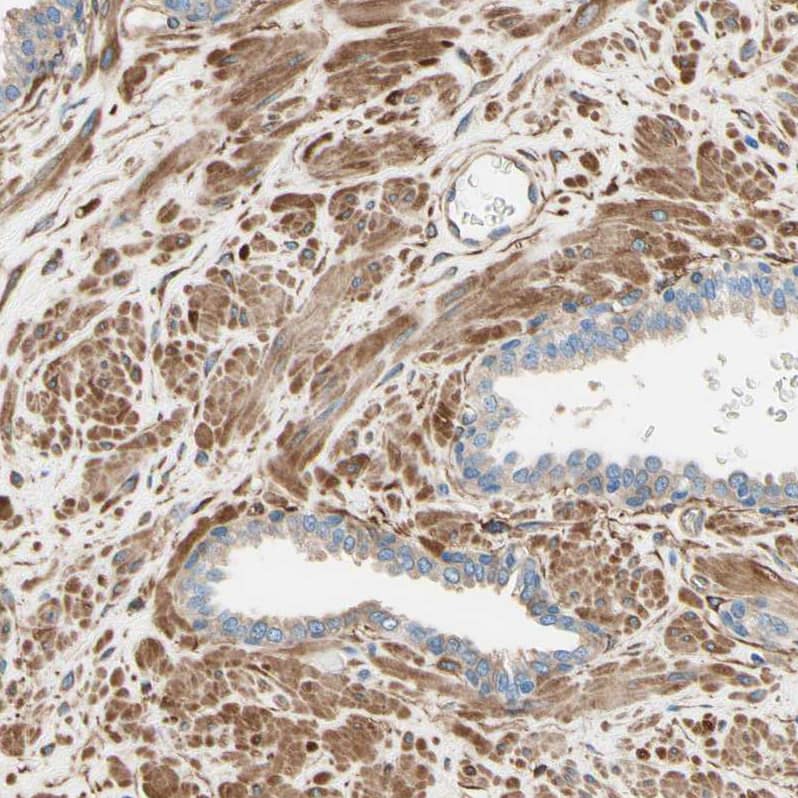 CRMP4 Antibody - BSA Free Immunohistochemistry-Paraffin: CRMP4 Antibody [NBP1-85447]