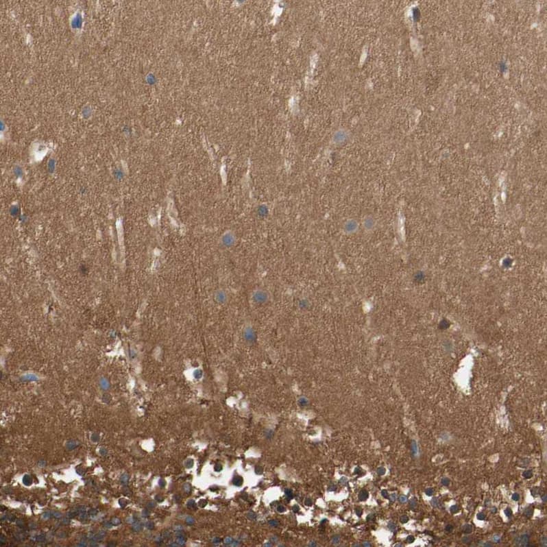 CRMP4 Antibody - BSA Free Immunohistochemistry-Paraffin: CRMP4 Antibody [NBP1-85447]