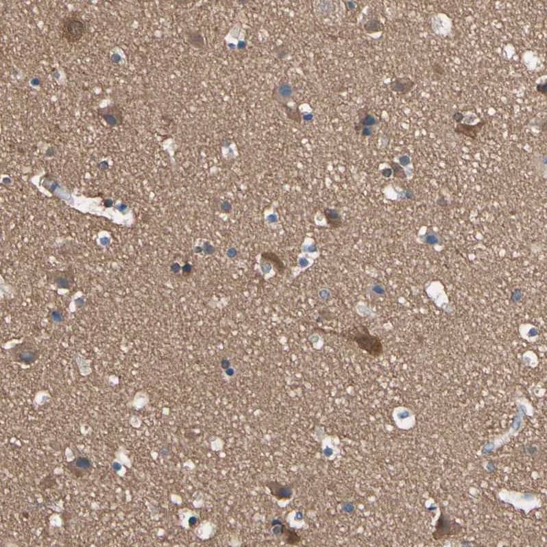 CRMP4 Antibody - BSA Free Immunohistochemistry-Paraffin: CRMP4 Antibody [NBP1-85447]