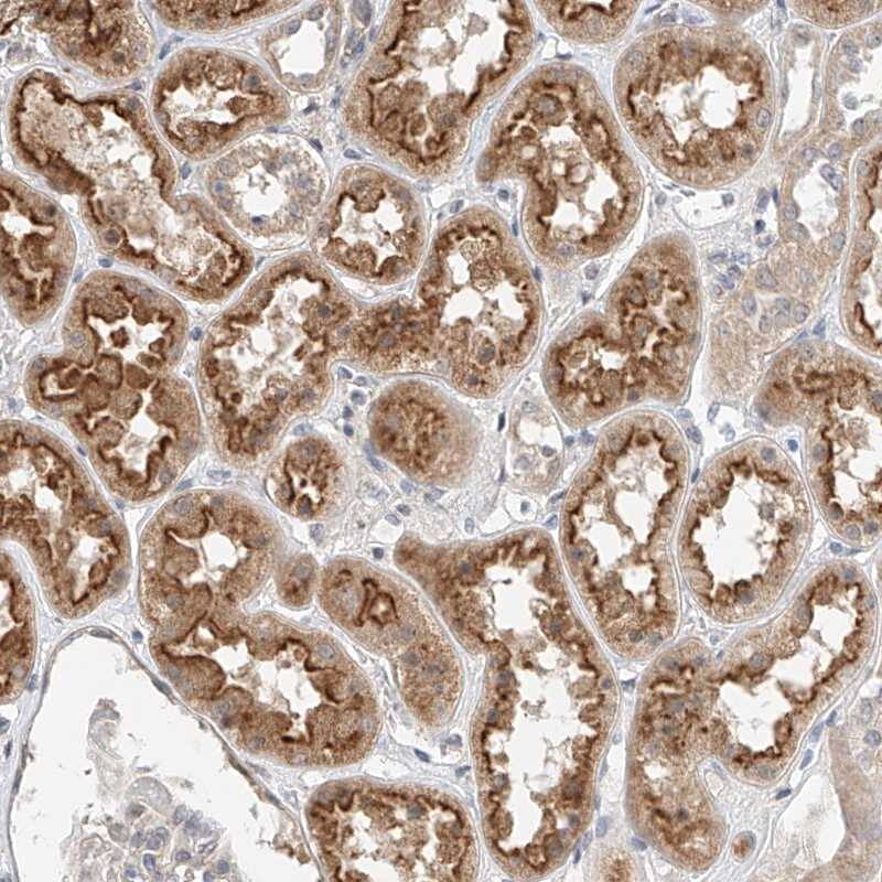 IL-22BP/IL22 RA2 Antibody - BSA Free Immunohistochemistry-Paraffin: IL-22BP/IL22 RA2 Antibody [NBP1-85455]