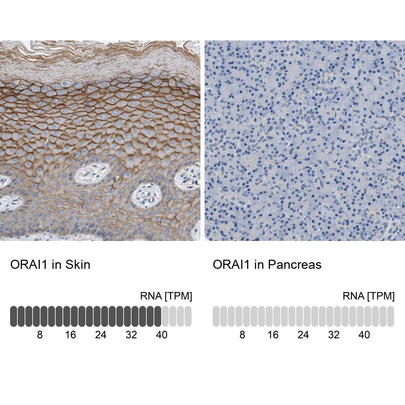 Orai1 Antibody - BSA Free Immunohistochemistry-Paraffin: Orai1 Antibody [NBP1-85463]