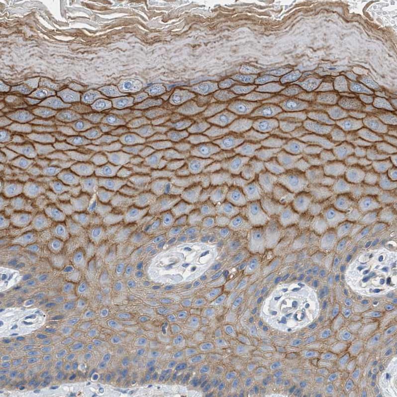Orai1 Antibody - BSA Free Immunohistochemistry-Paraffin: Orai1 Antibody [NBP1-85463]