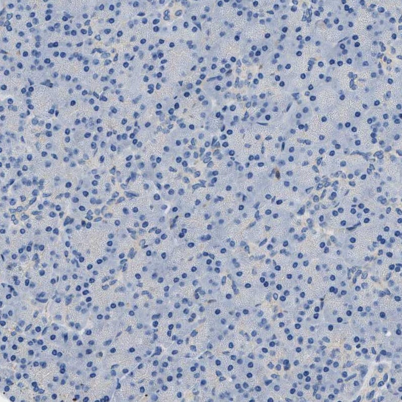 Orai1 Antibody - BSA Free Immunohistochemistry-Paraffin: Orai1 Antibody [NBP1-85463]