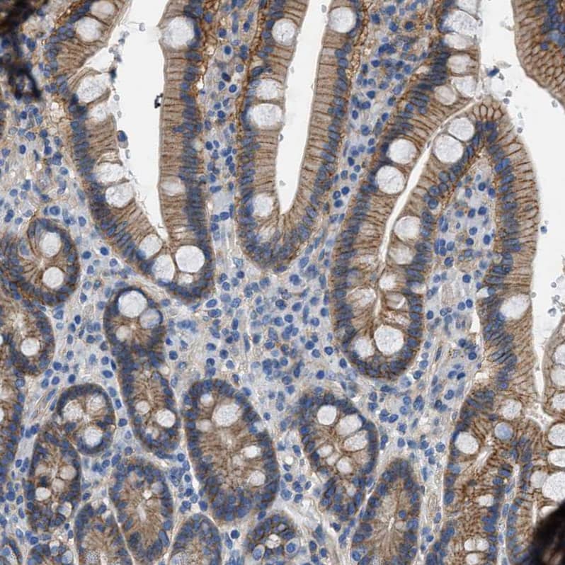 Orai1 Antibody - BSA Free Immunohistochemistry-Paraffin: Orai1 Antibody [NBP1-85463]