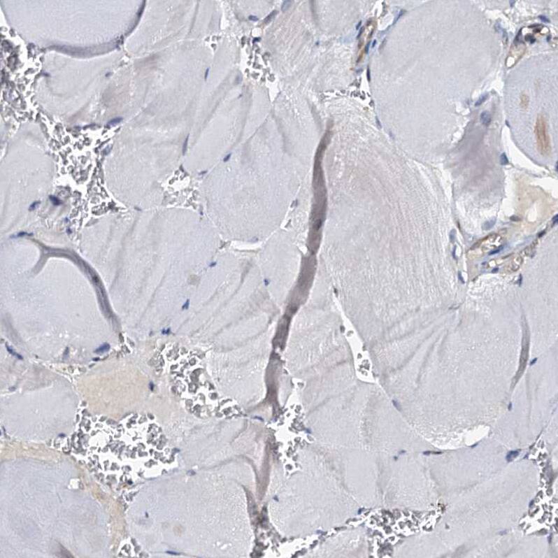p23/PTGES3 Antibody - BSA Free Immunohistochemistry-Paraffin: p23/PTGES3 Antibody [NBP1-85485]