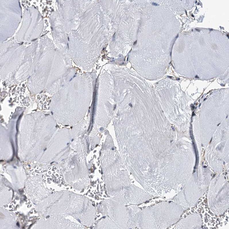p23/PTGES3 Antibody - BSA Free Immunohistochemistry-Paraffin: p23/PTGES3 Antibody [NBP1-85486]