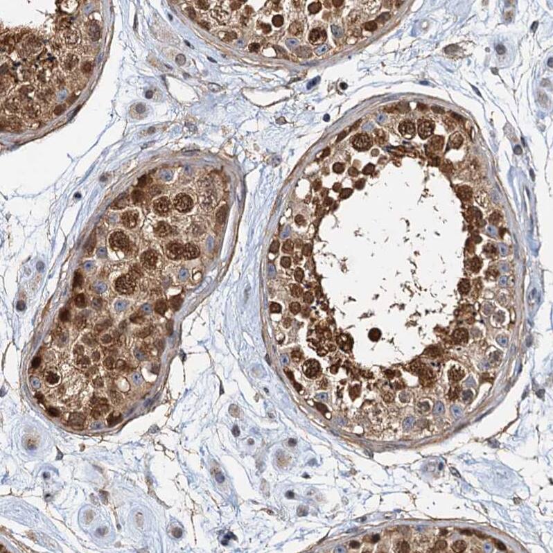 p23/PTGES3 Antibody - BSA Free Immunohistochemistry-Paraffin: p23/PTGES3 Antibody [NBP1-85486]