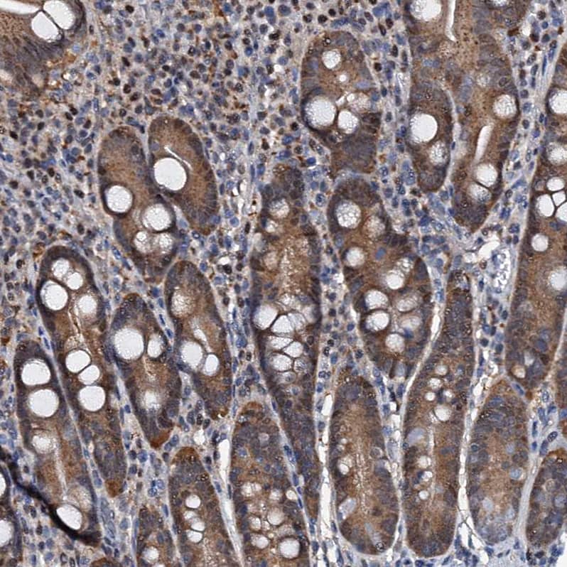 p23/PTGES3 Antibody - BSA Free Immunohistochemistry-Paraffin: p23/PTGES3 Antibody [NBP1-85486]
