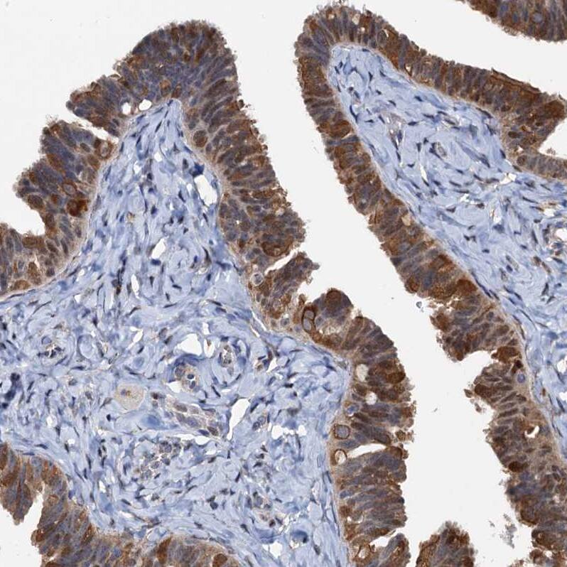 p23/PTGES3 Antibody - BSA Free Immunohistochemistry-Paraffin: p23/PTGES3 Antibody [NBP1-85486]