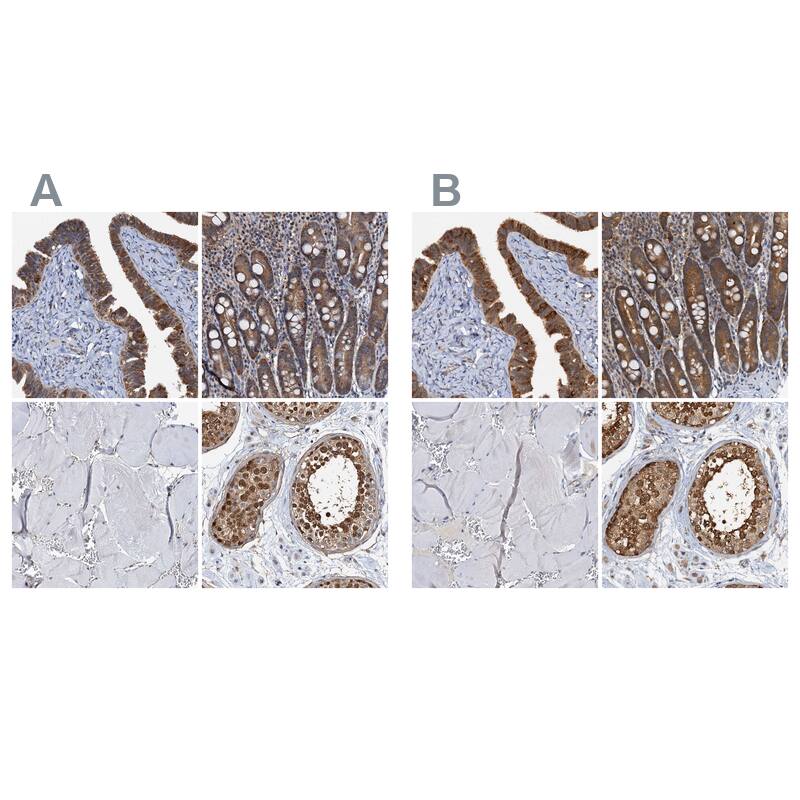 p23/PTGES3 Antibody - BSA Free Immunohistochemistry-Paraffin: p23/PTGES3 Antibody [NBP1-85486]