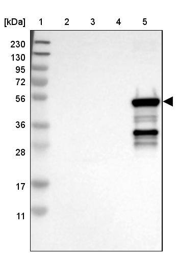 Cytochrome P450 2C9 Antibody - BSA Free Western Blot: Cytochrome P450 2C9 Antibody - BSA Free [NBP1-85488]