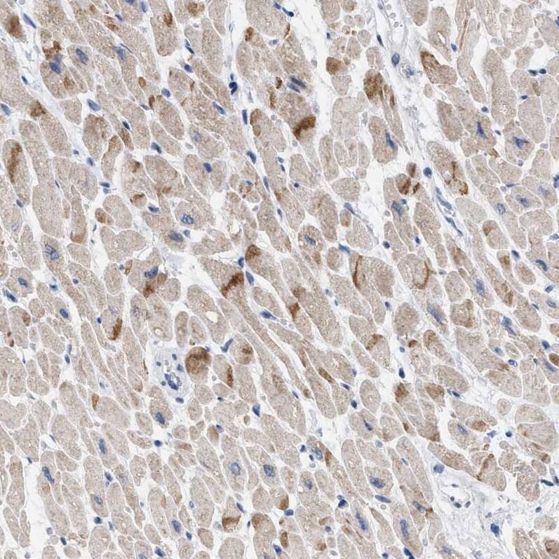 XIRP1 Antibody - BSA Free Immunohistochemistry-Paraffin: XIRP1 Antibody [NBP1-85530]