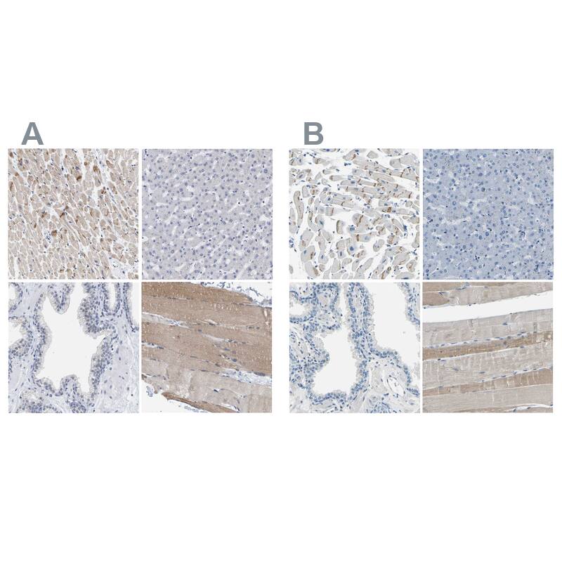 XIRP1 Antibody - BSA Free Immunohistochemistry-Paraffin: XIRP1 Antibody [NBP1-85530]