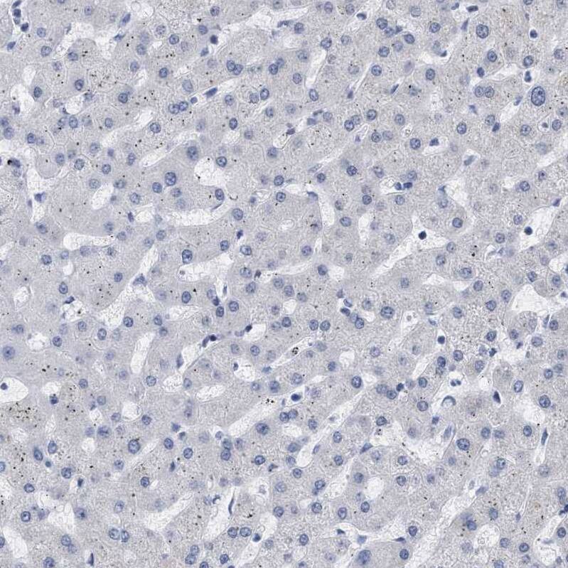 XIRP1 Antibody - BSA Free Immunohistochemistry-Paraffin: XIRP1 Antibody [NBP1-85530]