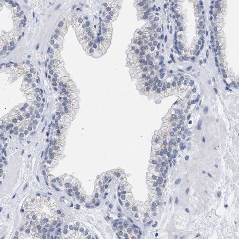 XIRP1 Antibody - BSA Free Immunohistochemistry-Paraffin: XIRP1 Antibody [NBP1-85530]