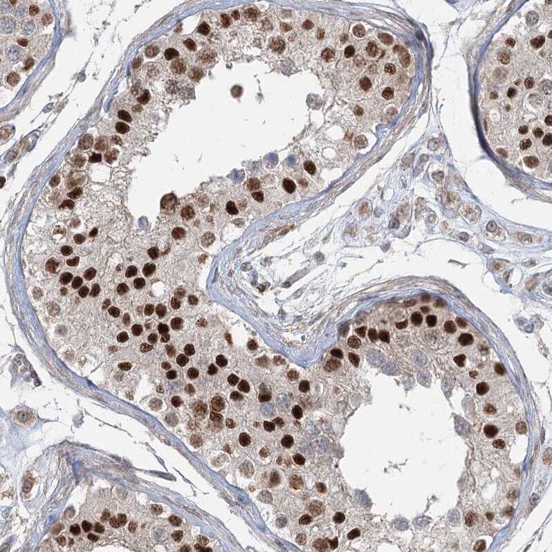 ZNF711 Antibody - BSA Free Immunohistochemistry-Paraffin: ZNF711 Antibody [NBP1-85538]