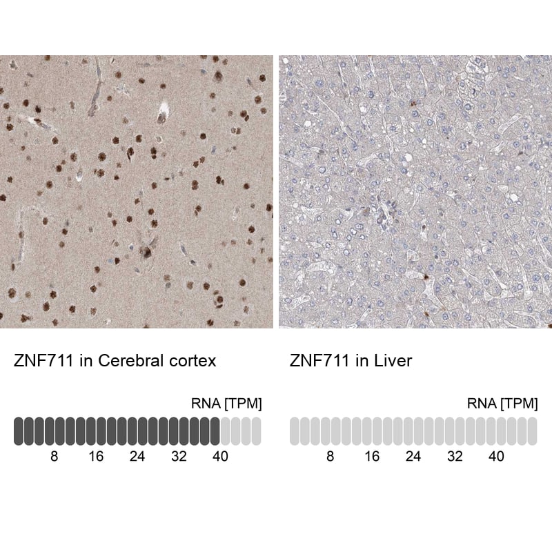 ZNF711 Antibody - BSA Free Immunohistochemistry-Paraffin: ZNF711 Antibody [NBP1-85538]