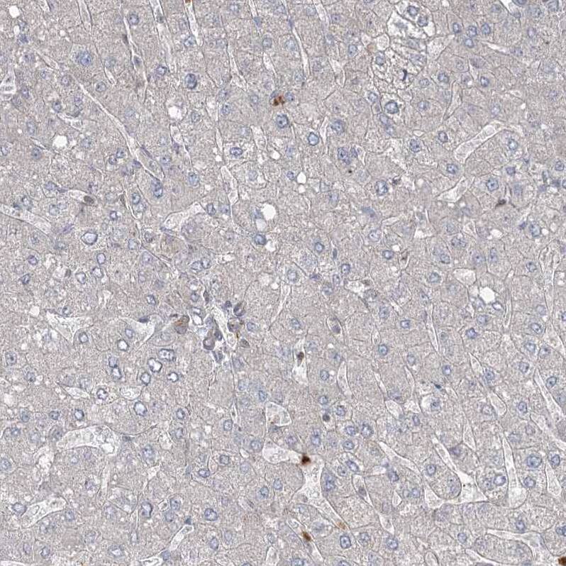 ZNF711 Antibody - BSA Free Immunohistochemistry-Paraffin: ZNF711 Antibody [NBP1-85538]