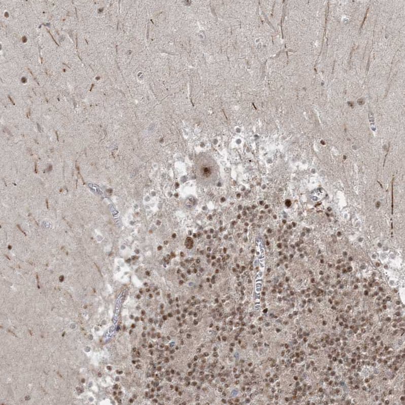 ZNF711 Antibody - BSA Free Immunohistochemistry-Paraffin: ZNF711 Antibody [NBP1-85538]
