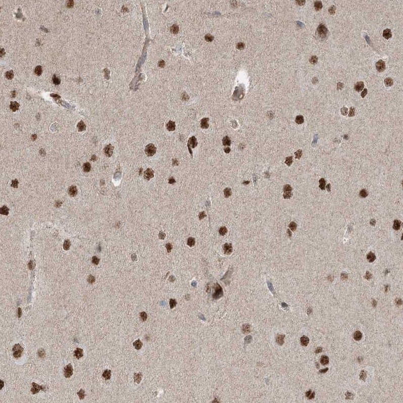 ZNF711 Antibody - BSA Free Immunohistochemistry-Paraffin: ZNF711 Antibody [NBP1-85538]