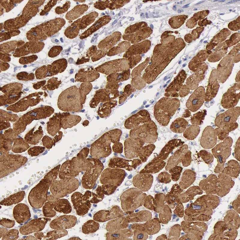 Myosin heavy chain 14 Antibody Immunohistochemistry-Paraffin: ODZ3 Antibody [NBP1-85542]