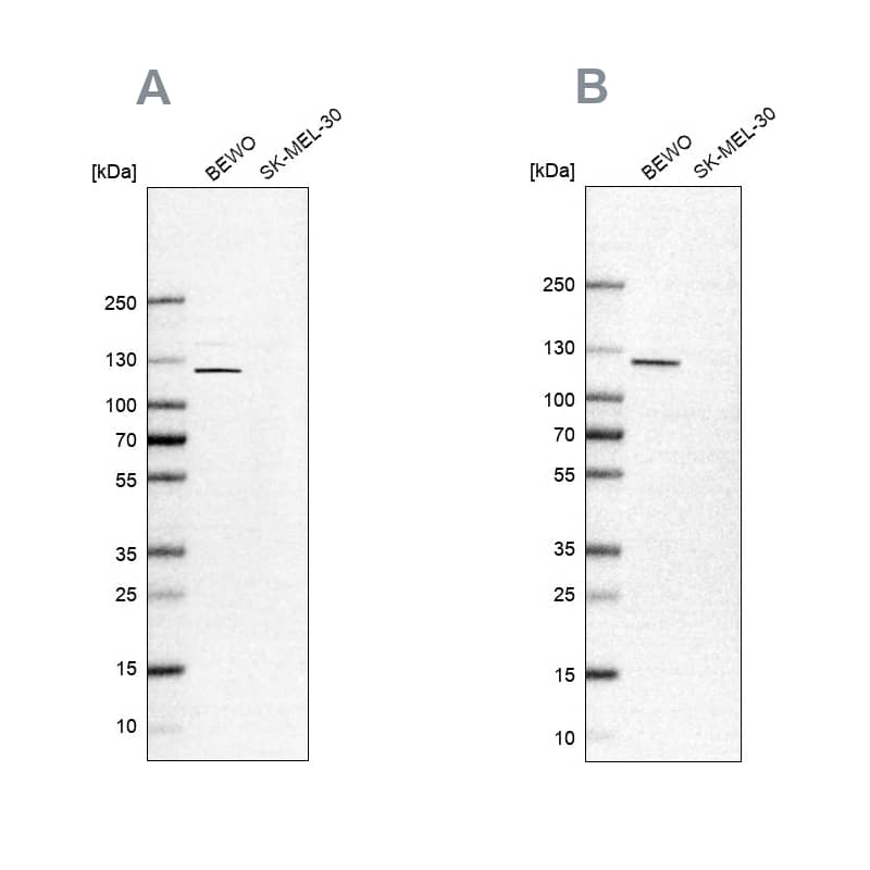 NLRP2/NALP2 Antibody Western Blot: NLRP2/NALP2 Antibody Antibody [NBP1-85553]