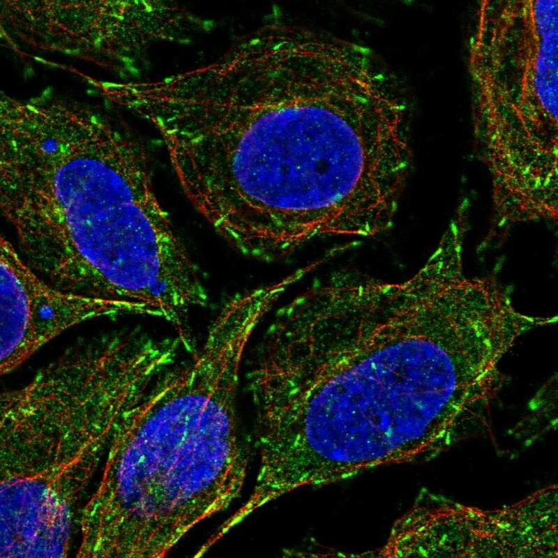 CLIP170 Antibody - BSA Free Immunocytochemistry/ Immunofluorescence: CLIP170 Antibody [NBP1-85568]