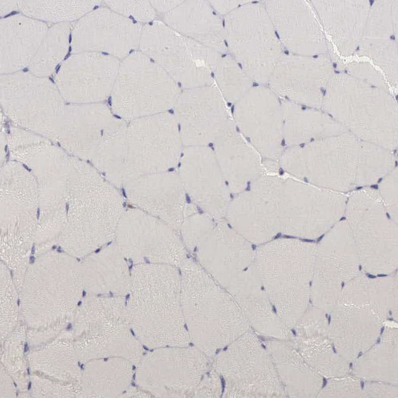 CKAP4/p63 Antibody - BSA Free Immunohistochemistry-Paraffin: CKAP4/p63 Antibody - BSA Free [NBP1-85571]