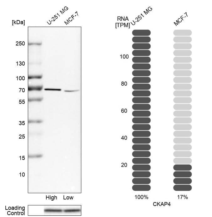 CKAP4/p63 Antibody - BSA Free Western Blot: CKAP4/p63 Antibody - BSA Free [NBP1-85571]