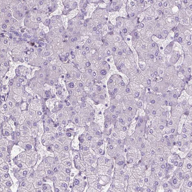CLIC4 Antibody - BSA Free Immunohistochemistry-Paraffin: CLIC4 Antibody - BSA Free [NBP1-85574]