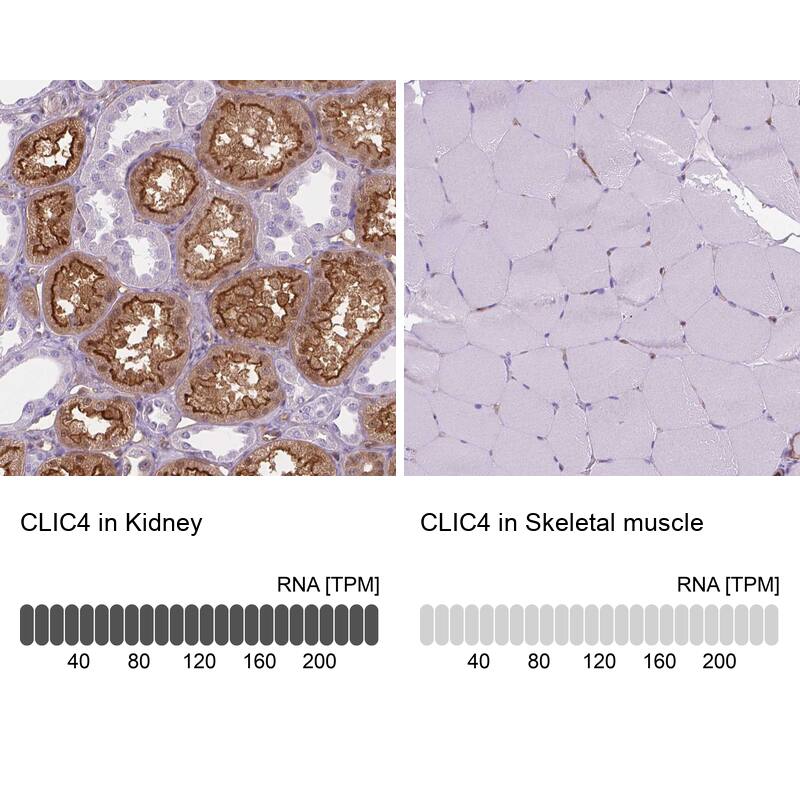 CLIC4 Antibody - BSA Free Immunohistochemistry-Paraffin: CLIC4 Antibody - BSA Free [NBP1-85574]